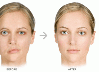 Facial Nerve facial nerve palsy